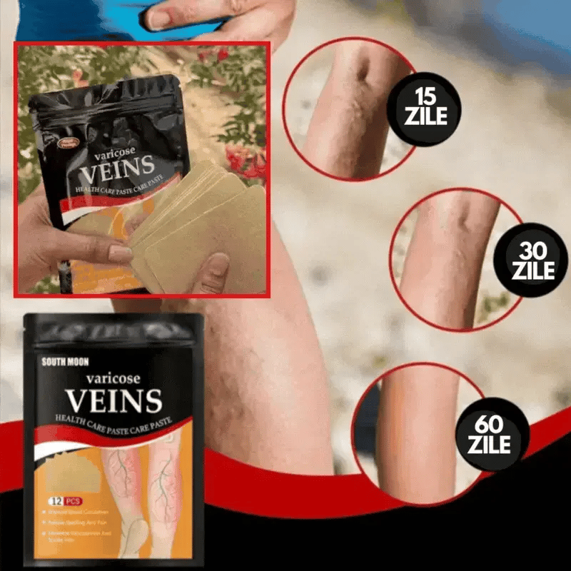 Plasturi Anti-Varice cu Turmeric - Pret Special